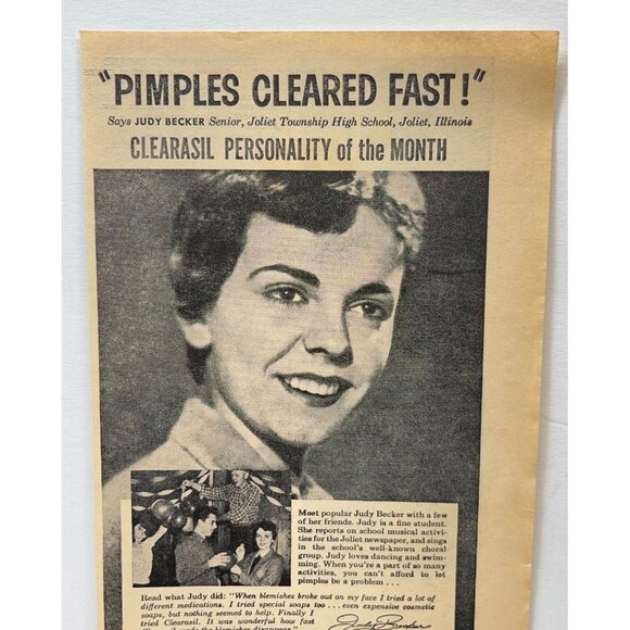 Clearasil Acne Medication Print Ad Vintage 1950s Starves Pimples - Picture 3 of 7